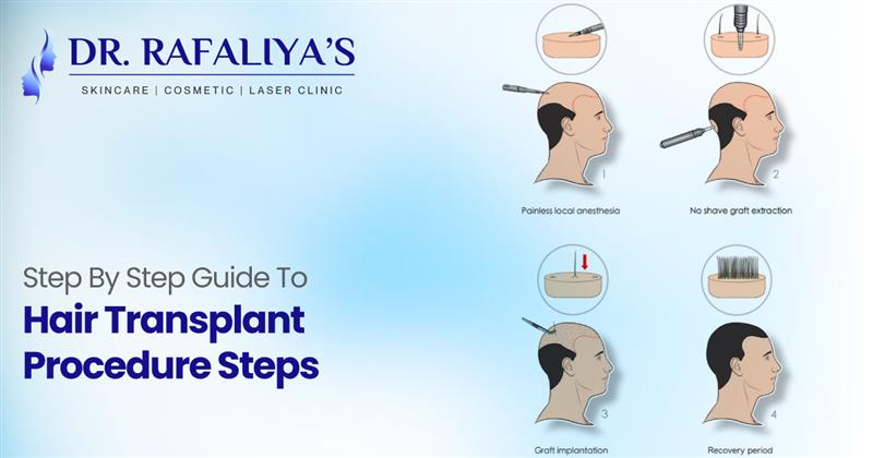 Hair Transplant Procedure Hair Transplant Procedure