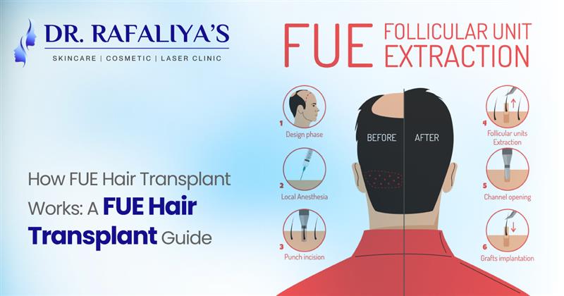 Hair Transplant Hair Transplant