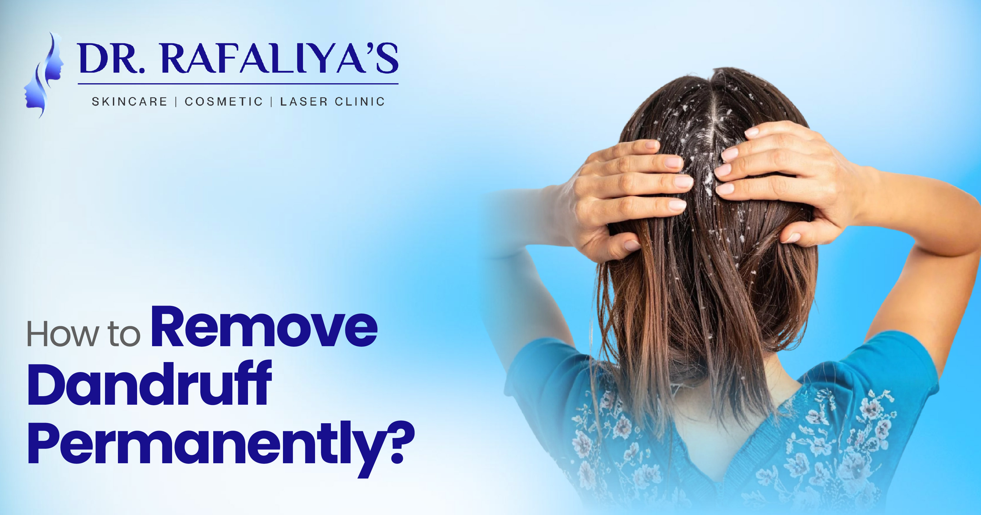How to Remove Dandruff Permanently?