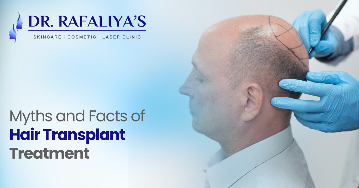 hair transplant treatment